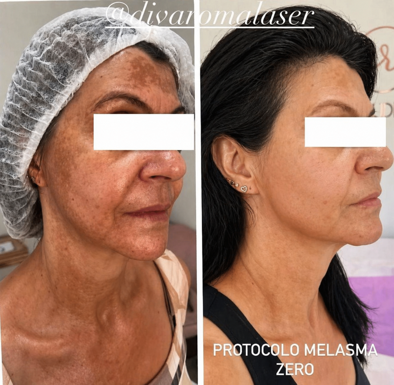 Resultado antes e depois 3